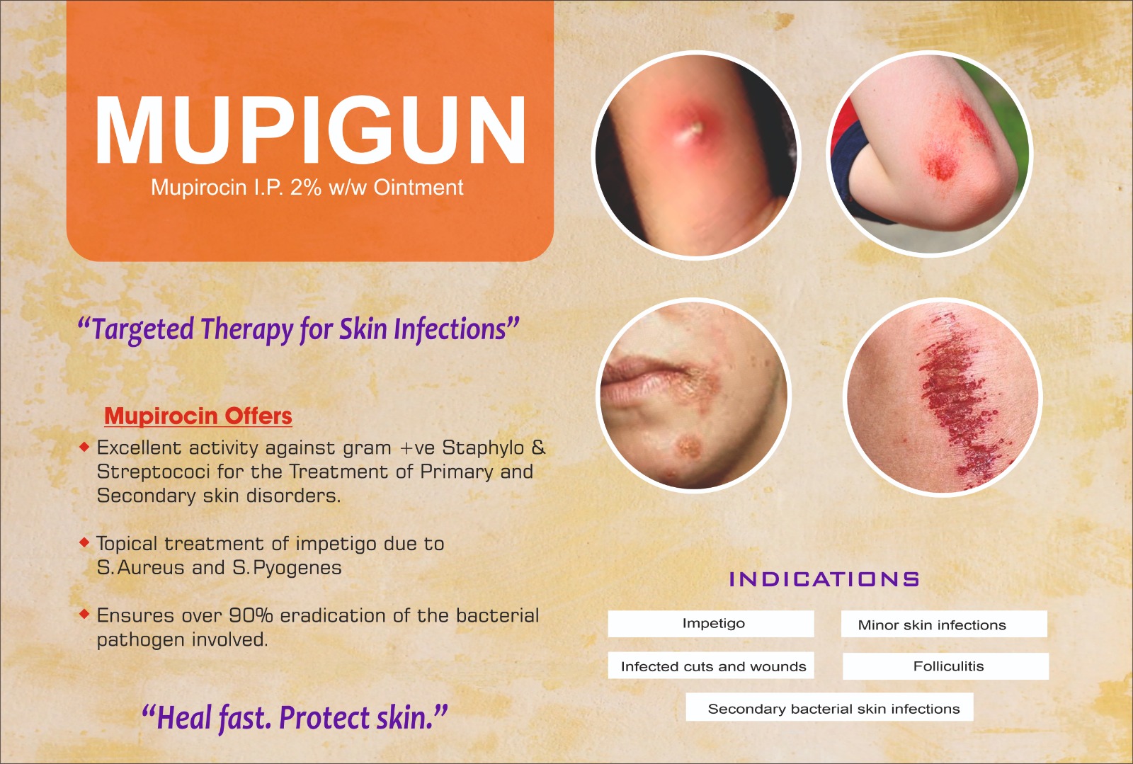 MUPIGUN promotional visual